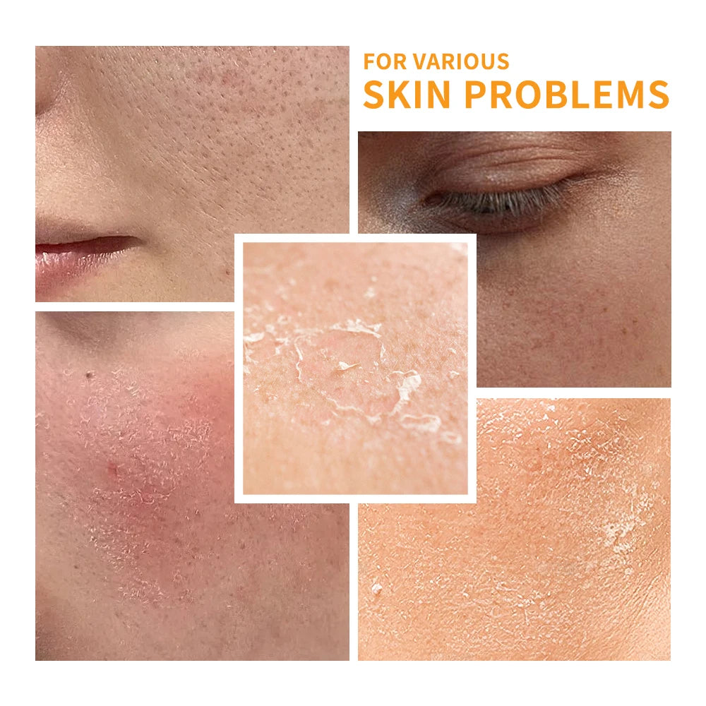 6pcs/set Vitamin C Skin Care Set Deep Cleansing Facial Cleanser Face Cream Moisturizing Anti Wrinkles Face Care Kit Gift Box