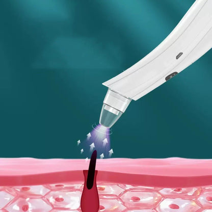 Home Use Beauty Devices Electric Blackhead Instrument Acne Pore Deep Cleaning Instrument New Pore Blackhead Instrument Tool