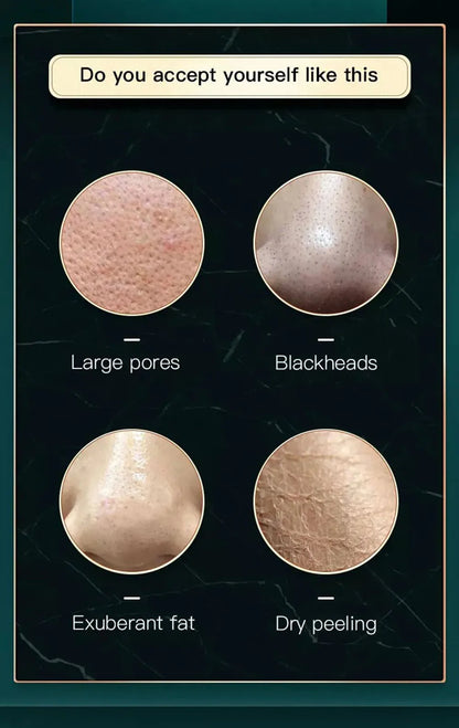 Peeling Beauty Device New Small Bubble Oxygen Injection Instrument Hydra Dermabrasion Aqua Facial Cleaning Suction Blackhead