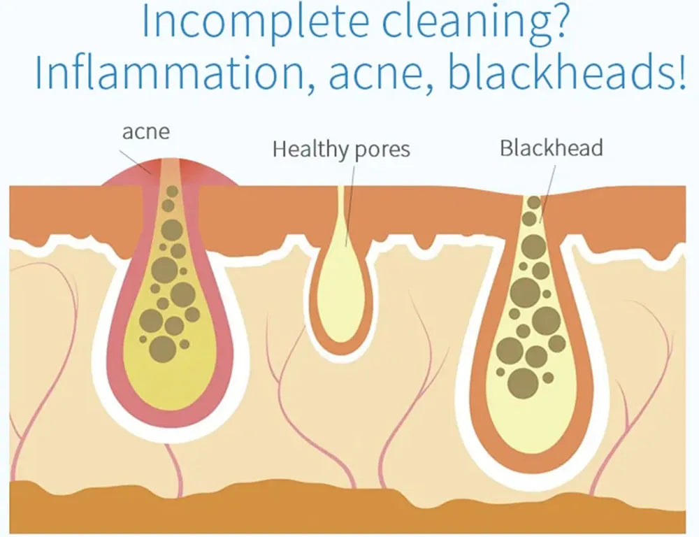 Peeling Beauty Device New Small Bubble Oxygen Injection Instrument Hydra Dermabrasion Aqua Facial Cleaning Suction Blackhead