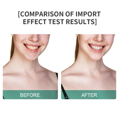 Beauty Device 2025 Microcurrent Massager Handheld Face Neck Lift Device Skin Tightening Lymphatic Drainage Skin Rejuvenation